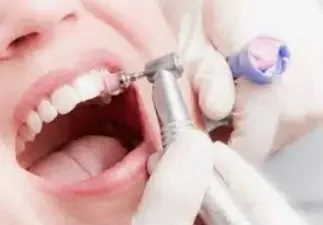 Гигиеническая чистка зубов в Благовещенске