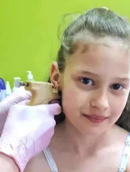 Прокалывание ушей