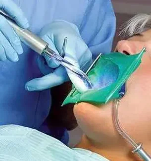 Ультразвуковое удаление зубных отложений