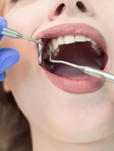 Фото для Лечение пульпита у детей