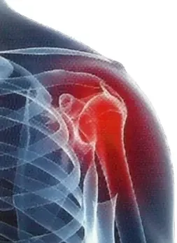 Рентгенография плечевого сустава