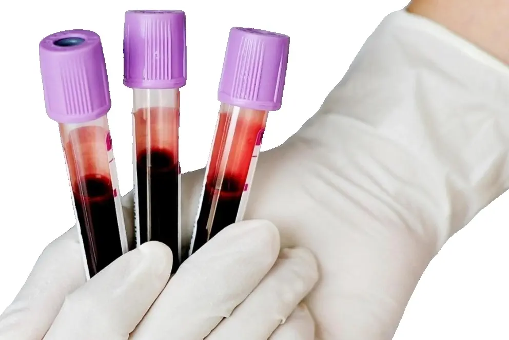 Исследование уровня аланин-трансаминазы (АЛТ) в крови