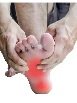 Рентгенография одной стопы