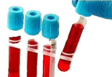Определение ДНК вируса гепатита С в крови методом ПЦР, качественное исследование