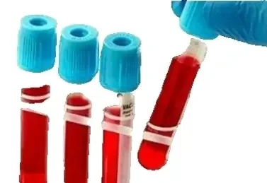 Фото для Определение ДНК вируса гепатита С в крови методом ПЦР, качественное исследование