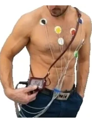 Холтеровское мониторирование ЭКГ