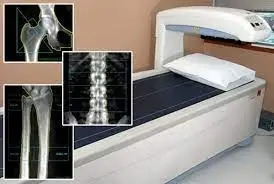 Рентгеновская денситометрия