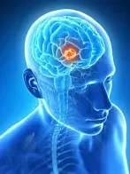 МРТ головного мозга высокого разрешения (эписиндром)
