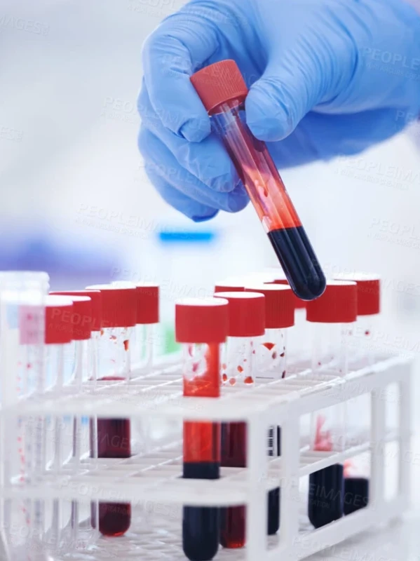 Гепатит С с подтверждающим HCV IgG и IgM, ИФА. Гепатит В с подтверждающим HBs-Ag, ИФА