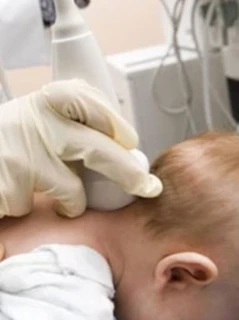 Нейросонография с доплером (УЗИ головного мозга)