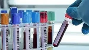 Исследование уровня фолликулостимулирующего гормона в крови