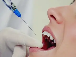 Анестезия при лечении зуба